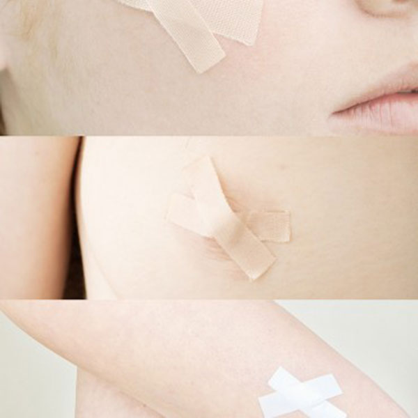 TRAITEMENT DES CICATRICES